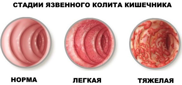 Кровохлебка. Лечебные свойства травы, фото, применение корней, цветков растения, противопоказания